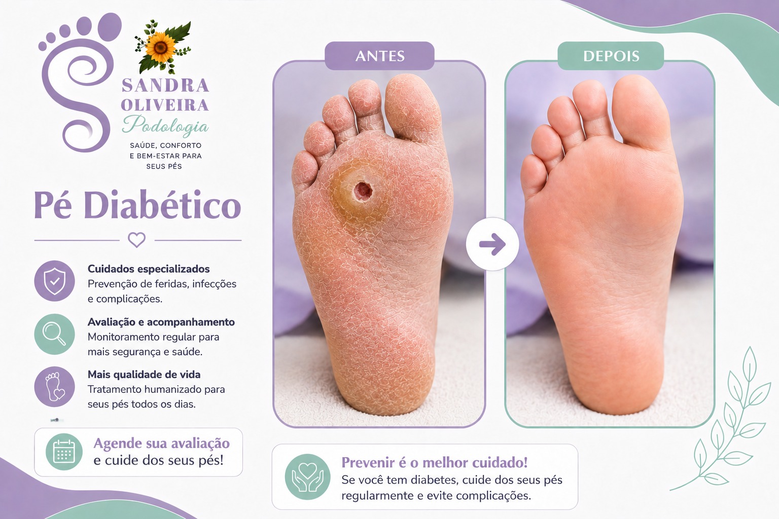 Prevenção e cuidados com Pé Diabético